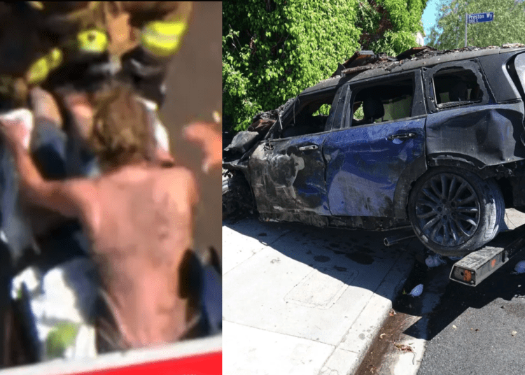 Actress severely burned after crashing car into Los Angeles home Law